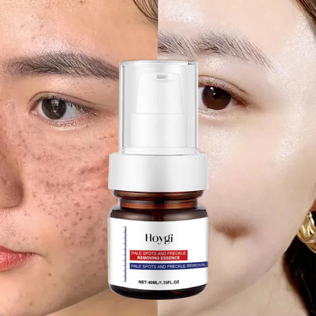 🔥HOT SALE 50%OFF Today🔥Vitamin C whitening freckle face cream