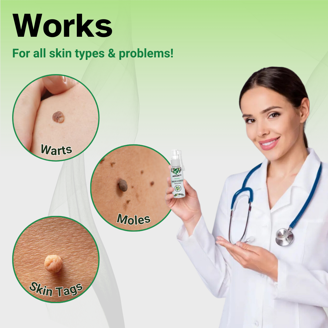 EELHOE™ Herbal Moles & Warts Removal Spray