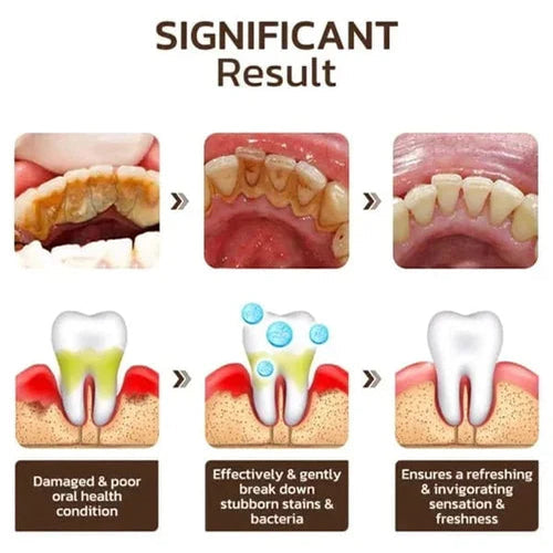 🔥HOT SALE🔥SP-6 Whitening Toothpaste丨Powerful Oral Health & Disease Treatment