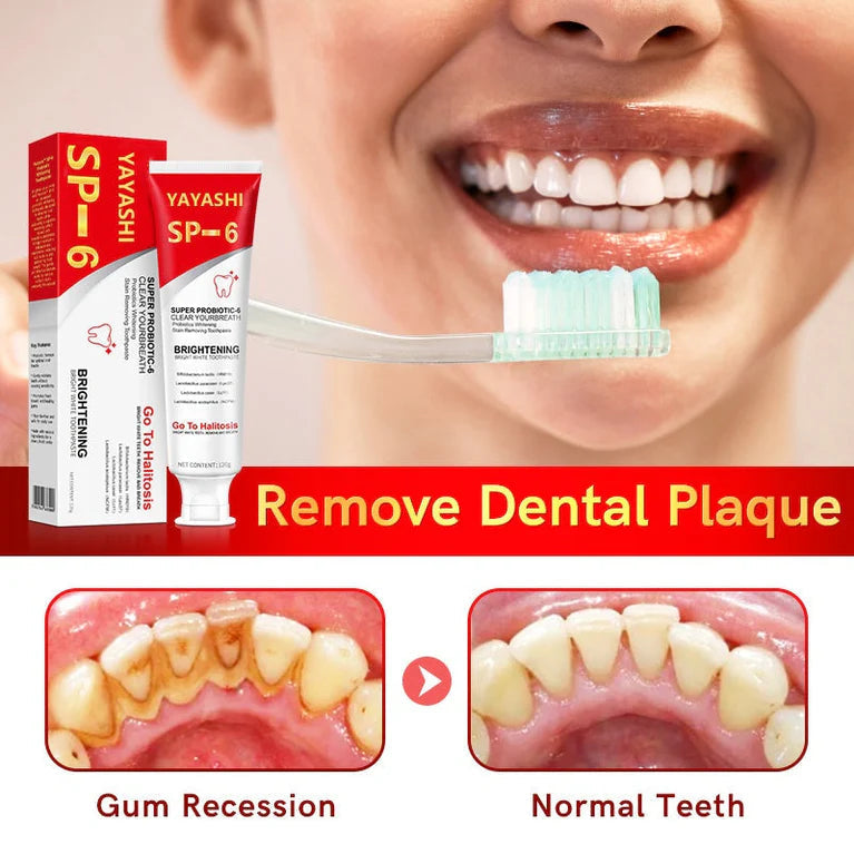 🔥HOT SALE🔥SP-6 Whitening Toothpaste丨Powerful Oral Health & Disease Treatment