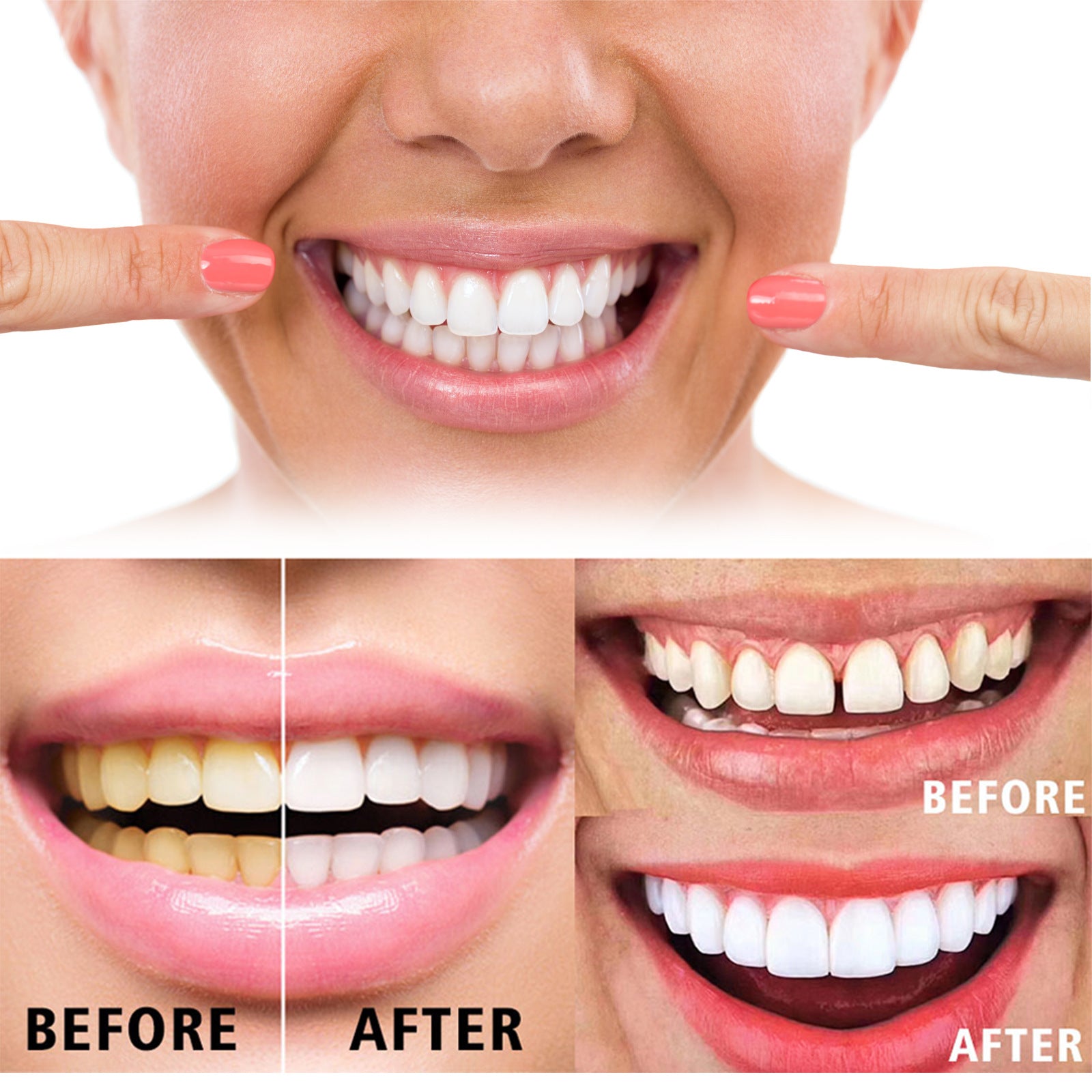 💎JAYSUING™ Teeth Whitening Repair Regrowth Dental Gel